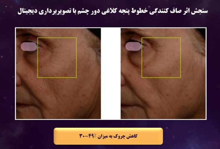 بهترین کرم ضد چروک برای پوست خشک | آبرسان قوی | آبرسانی پوست | پوست خشک | تراست | جوانسازی پوست | چین و چروک | زیبایی پوست | ضد چروک | فروشگاه آنلاین | کرم ضد چروک | کرم مناسب پوست خشک | مراقبت پوست | هیالورونیک اسید