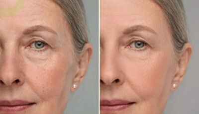 روش استفاده رتینول تراست (راهنمای گام به گام) | خرید قسطی اسنپ‌پی