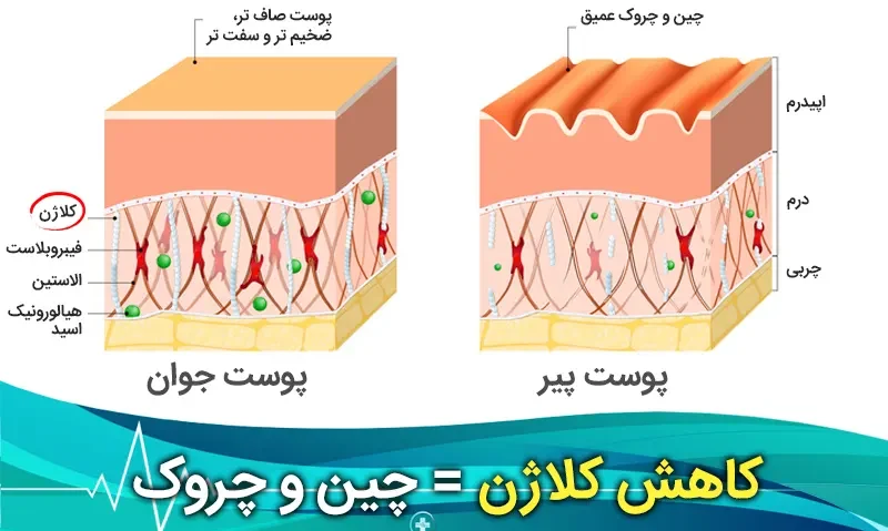 🔬 عملکرد شگفتانگیز رتینول
رتینول (Retinol)، یکی از مشتقات قدرتمند ویتامین A، به عنوان یکی از مؤثرترین مواد ضد پیری شناخته میشود که عملکرد دوگانهای در لایههای مختلف پوست دارد. پس از جذب، رتینول در سلولهای پوستی به رتینوئیک اسید تبدیل میشود که فرم فعال و قابل شناسایی توسط هسته سلول است. در لایه بالایی پوست (اپیدرم)، رتینول با تسریع چرخه بازسازی سلولها، به نوعی لایه برداری ملایم انجام داده و باعث حذف سریعتر سلولهای مرده میشود که نتیجه آن پوستی روشنتر، صافتر و یکدستتر است. در لایه عمقی (درم)، رتینوئیک اسید به سلولهای فیبروبلاست پیام میدهد تا تولید کلاژن و الاستین را افزایش دهند. این تحریک پروتئینسازی، ساختار حمایتی پوست را تقویت کرده، چروکهای موجود را پر میکند و خاصیت ارتجاعی و استحکام از دست رفته پوست را بازمیگرداند.